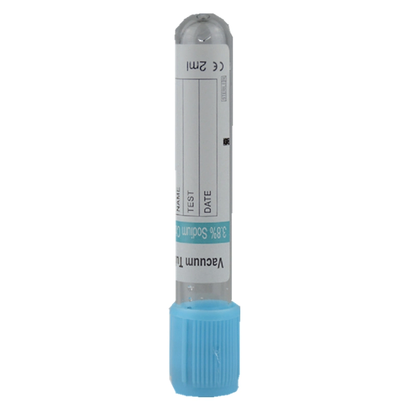  Blut-Sammlungs-Rohr-Fabrikpreis des Haustier-Natriumcitrat-3,2%