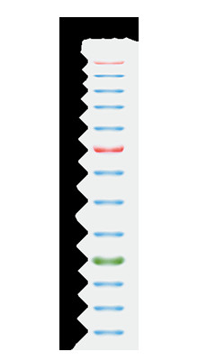 11 der Band-9-180KDA blaue des oberen Bereichs Farbe 25-300kDa der Protein-Markierungs-2x250ul 3